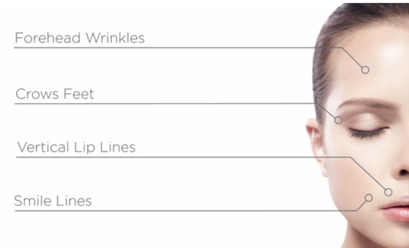 FULLFILL™ Hyaluronic Acid Topical Wrinkle Filler Dermarche Labs Sephora